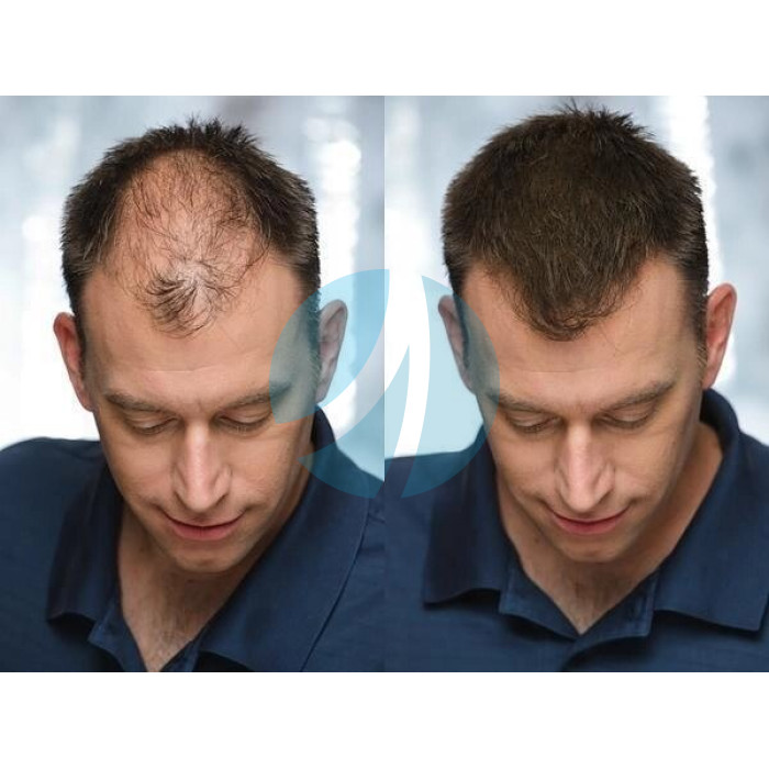 Загущувач для волосся toppik hair building fibers колір чорний Загущувач для волосся toppik hair building fibers колір чорний