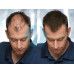 Загущувач для волосся toppik hair building fibers колір чорний