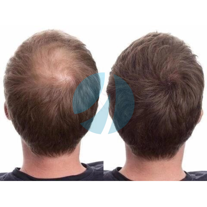 Загущувач для волосся toppik hair building fibers колір чорний Загущувач для волосся toppik hair building fibers колір чорний