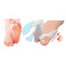 Фіксатор для корекції кісточки великого пальця ноги valgus pro