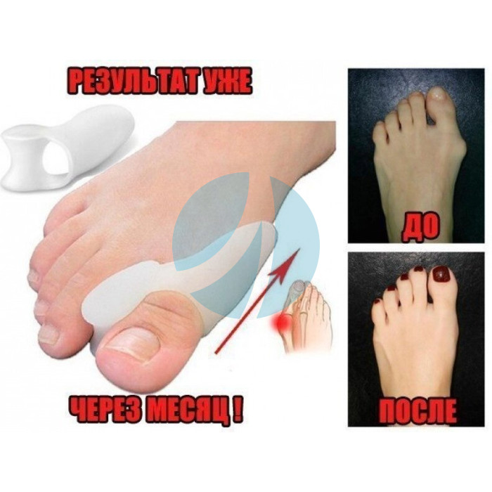 Фіксатор для корекції кісточки великого пальця ноги valgus pro Фіксатор для корекції кісточки великого пальця ноги valgus pro