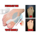 Фіксатор для корекції кісточки великого пальця ноги valgus pro