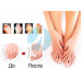 Фіксатор для корекції кісточки великого пальця ноги valgus pro