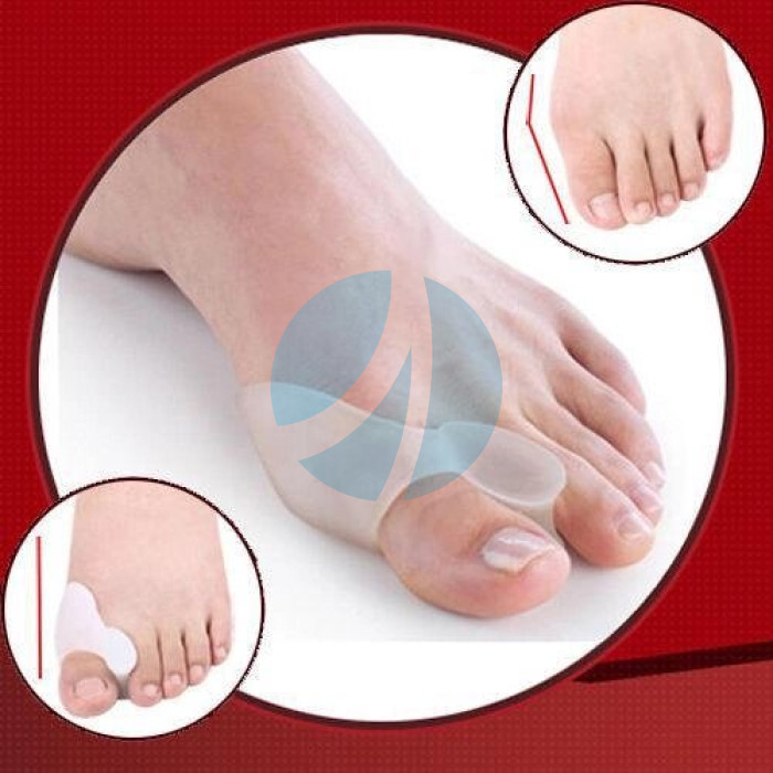 Фіксатор для корекції кісточки великого пальця ноги valgus pro Фіксатор для корекції кісточки великого пальця ноги valgus pro